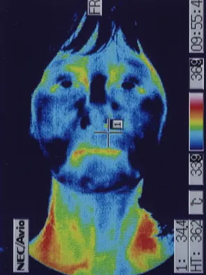 用热成像技术确定面部的温度